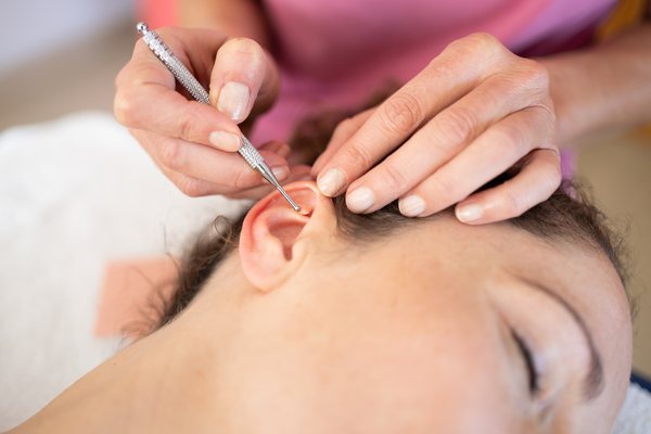 séance d'auriculothérapie à Vincennes : stimulation d'un point réflexe du pavillon de l'oreille